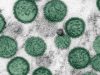 OMS descarta emergencia sanitaria global por hantavirus: “No es el inicio de una pandemia”