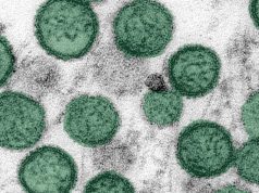 OMS descarta emergencia sanitaria global por hantavirus: “No es el inicio de una pandemia”