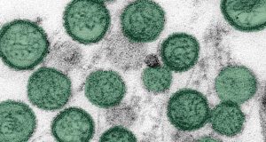 OMS descarta emergencia sanitaria global por hantavirus: “No es el inicio de una pandemia”