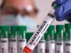 Secretaría de Salud emite aviso epidemiológico por hantavirus