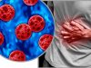 Confirman 33 casos de ciclosporiasis en México; descartan vínculo con brote en Estados Unidos