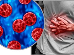 Confirman 33 casos de ciclosporiasis en México; descartan vínculo con brote en Estados Unidos